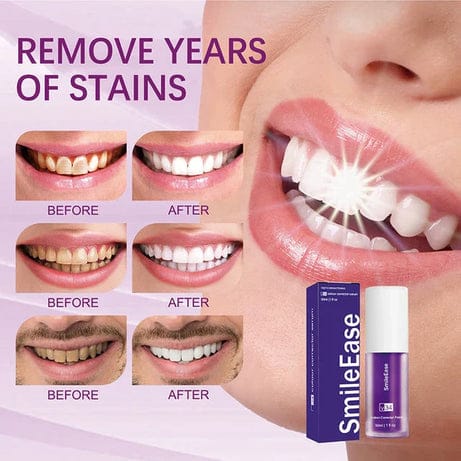 Teeth Brightening HiSmile V34 Colour Corrector Serum