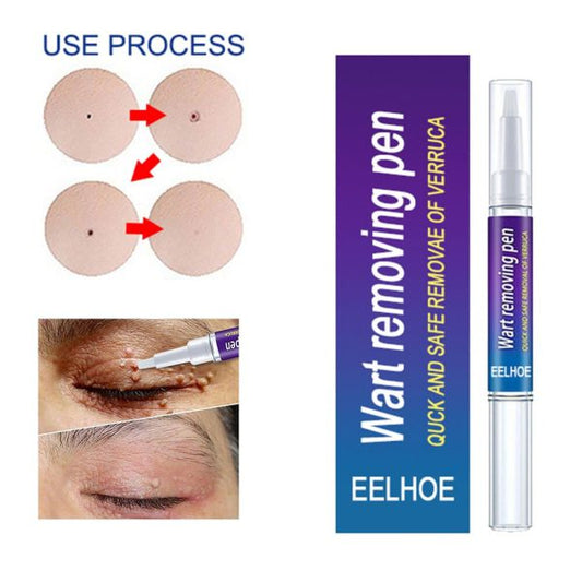 Warts Remover Original Cream Wart Removal Ointment